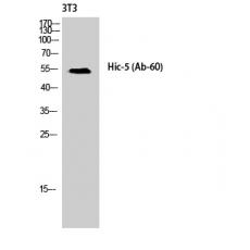 Anti-Hic-5 antibody