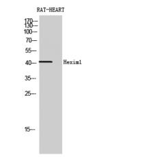 Anti-Hexim1 antibody