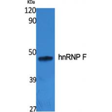 Anti-hnRNP F antibody