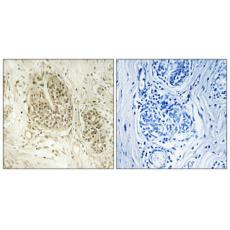 Anti-NOC2L antibody