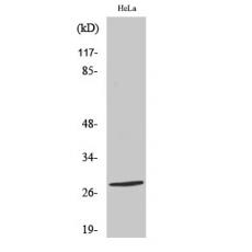 Anti-Nkx-2.6 antibody