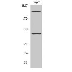 Anti-NP220 antibody