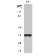 Anti-Olfactory receptor 52W1 antibody