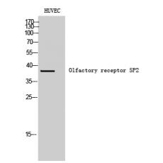 Anti-Olfactory receptor 5P2 antibody