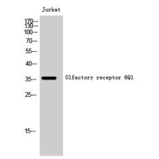Anti-Olfactory receptor 6Q1 antibody
