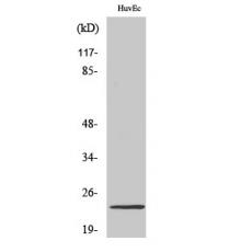 Anti-NBK antibody