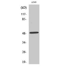 Anti-NARFL antibody