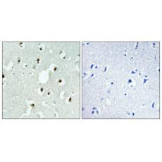 Anti-MLH3 antibody