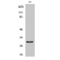 Anti-MRP-L10 antibody