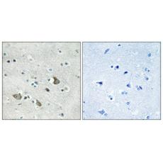Anti-MRP-L32 antibody
