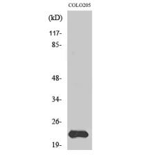 Anti-MRP-L40 antibody
