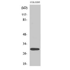 Anti-MRP-L9 antibody