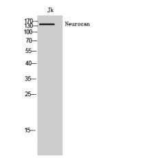 Anti-Neurocan antibody