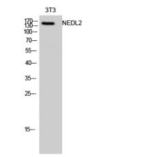 Anti-NEDL2 antibody