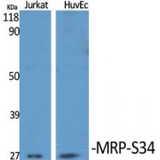 Anti-MRP-S34 antibody