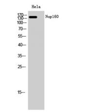Anti-Nup160 antibody
