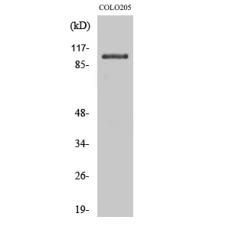 Anti-OCRL antibody