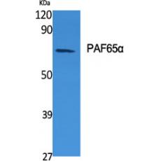 Anti-PAF65α antibody
