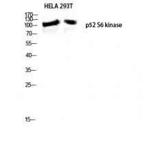 Anti-p52 S6 kinase antibody