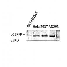 Anti-p53RFP antibody