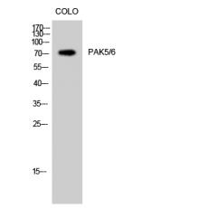 Anti-PAK5/6 antibody