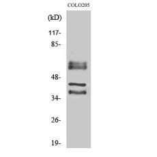 Anti-Periphilin 1 antibody