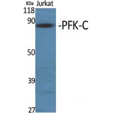 Anti-PFK-C antibody