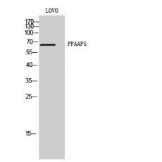 Anti-PFAAP5 antibody