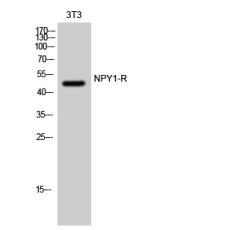 Anti-NPY1-R antibody