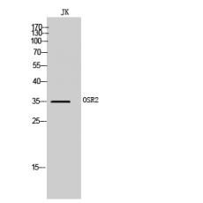 Anti-OSR2 antibody