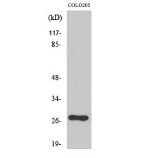 Anti-OTUB2 antibody