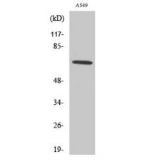 Anti-Nox3 antibody