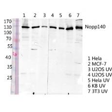 Anti-Nopp140 antibody