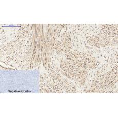 Anti-PI 3-kinase p85α/γ antibody