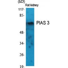 Anti-PIAS 3 antibody