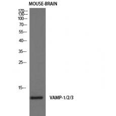 Anti-VAMP-1/2/3 antibody