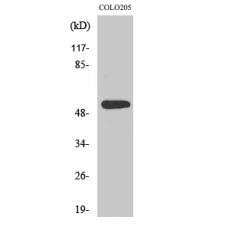 Anti-XPLN antibody