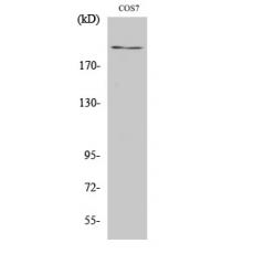 Anti-ZFP106 antibody