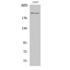 Anti-ZFP106 antibody