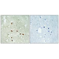 Anti-Rag A/B antibody