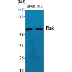 Anti-Rak antibody