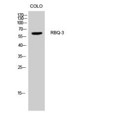 Anti-RBM34 antibody