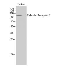 Anti-Relaxin Receptor 2 antibody