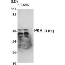 Anti-PKA Iα reg antibody