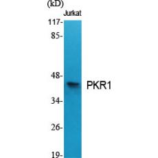 Anti-PKR1 antibody