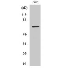 Anti-POT1 antibody
