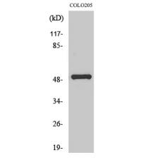 Anti-PPP4R1L antibody