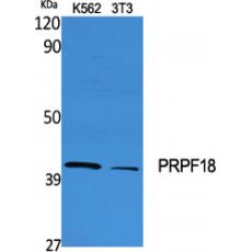 Anti-PRPF18 antibody