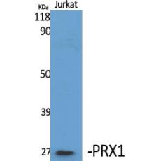 Anti-PRX1 antibody