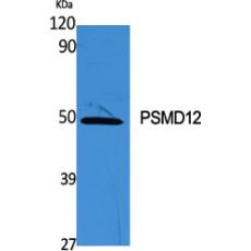 Anti-PSMD12 antibody